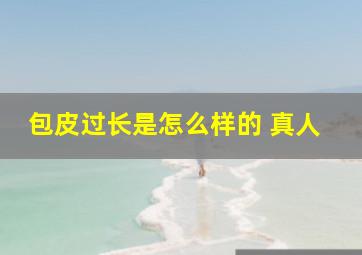 包皮过长是怎么样的 真人